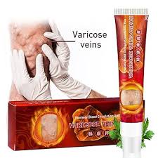 CREMA PARA EL TRATAMIENTO DE LAS VARICES